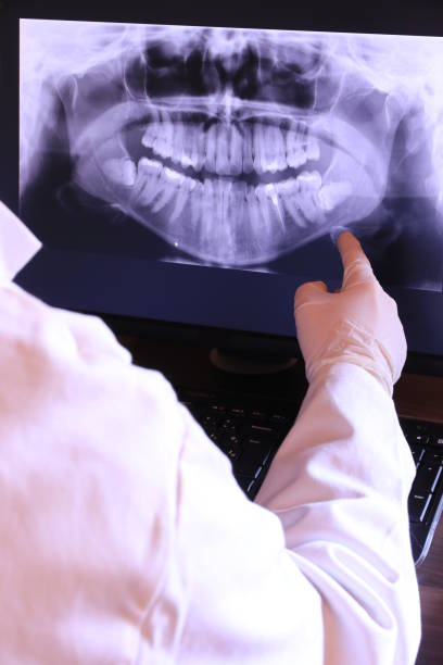 Best Dentist for Tooth Abscess  in Ithaca, MI